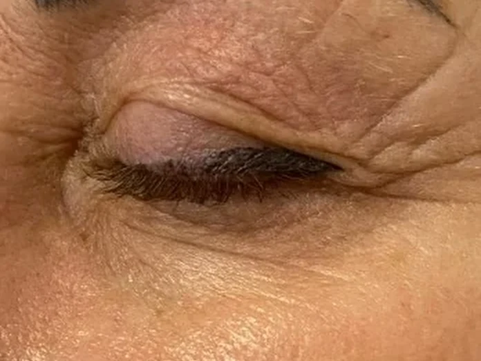 Външният ъгъл на окото преди Foxy Eyes