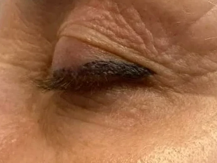 Повдигнатият външен ъгъл на окото след Foxy Eyes в Denny Divine